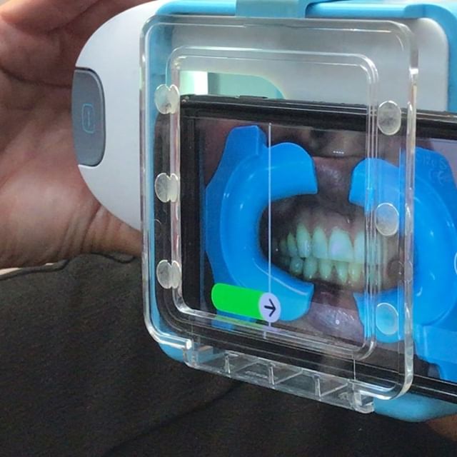 Super cool but highly useful and innovative tech with dental monitoring 
Excited to get it going in our practice #clearcorrect #iasortho #inmanaligner #dentalmonitoring #dentaltechnology #scanning #aligners #remotemonitoring #whiteteeth #teeth #smile.